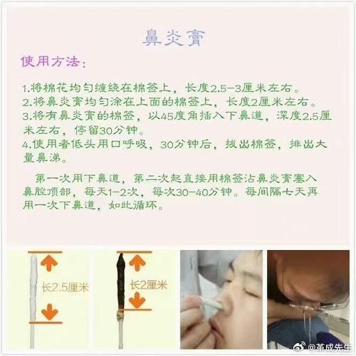 鼻炎秘方