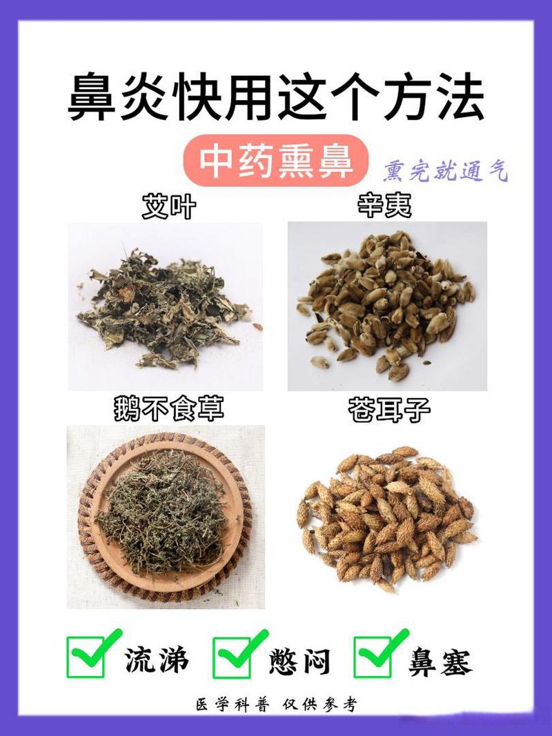 中药熏鼻炎