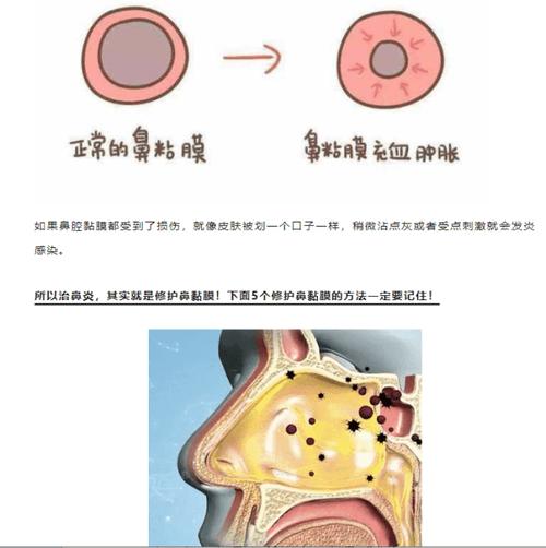 探秘：贻贝对鼻炎的疗效是否属实？