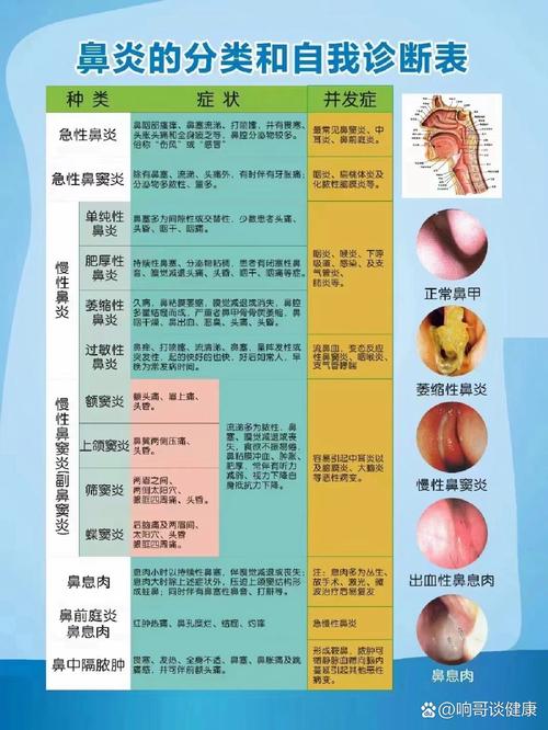 <鼻炎>