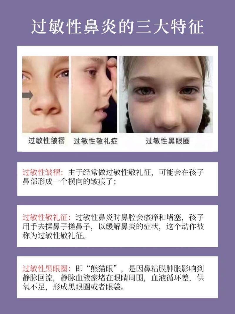 过敏性鼻炎如何引发频繁眨眼的行为？