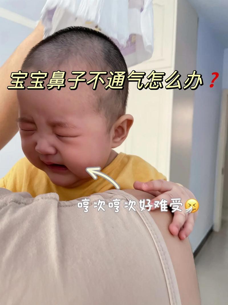 幼儿鼻炎鼻塞