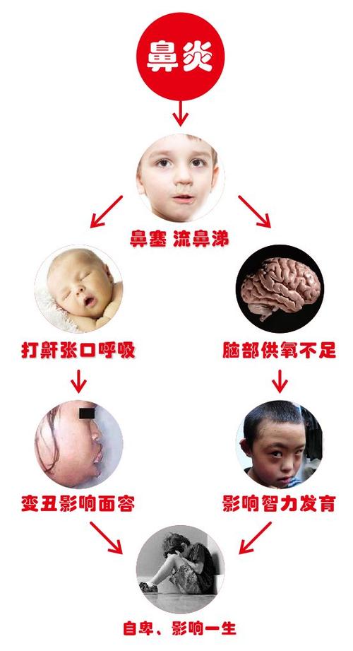 吸毒后遗症：戒毒成功却患上鼻炎？