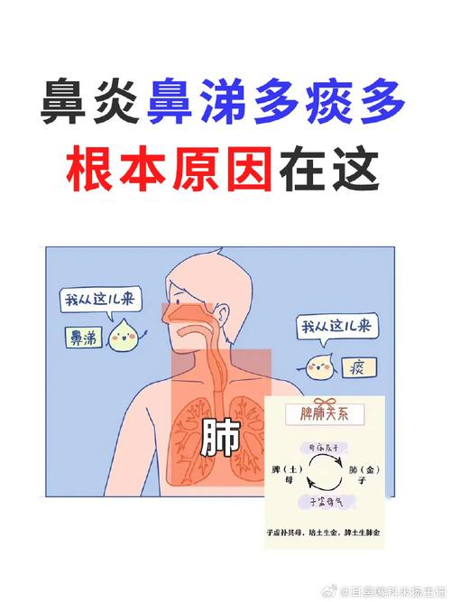 鼻炎的症状之一就是打喷嚏吗？