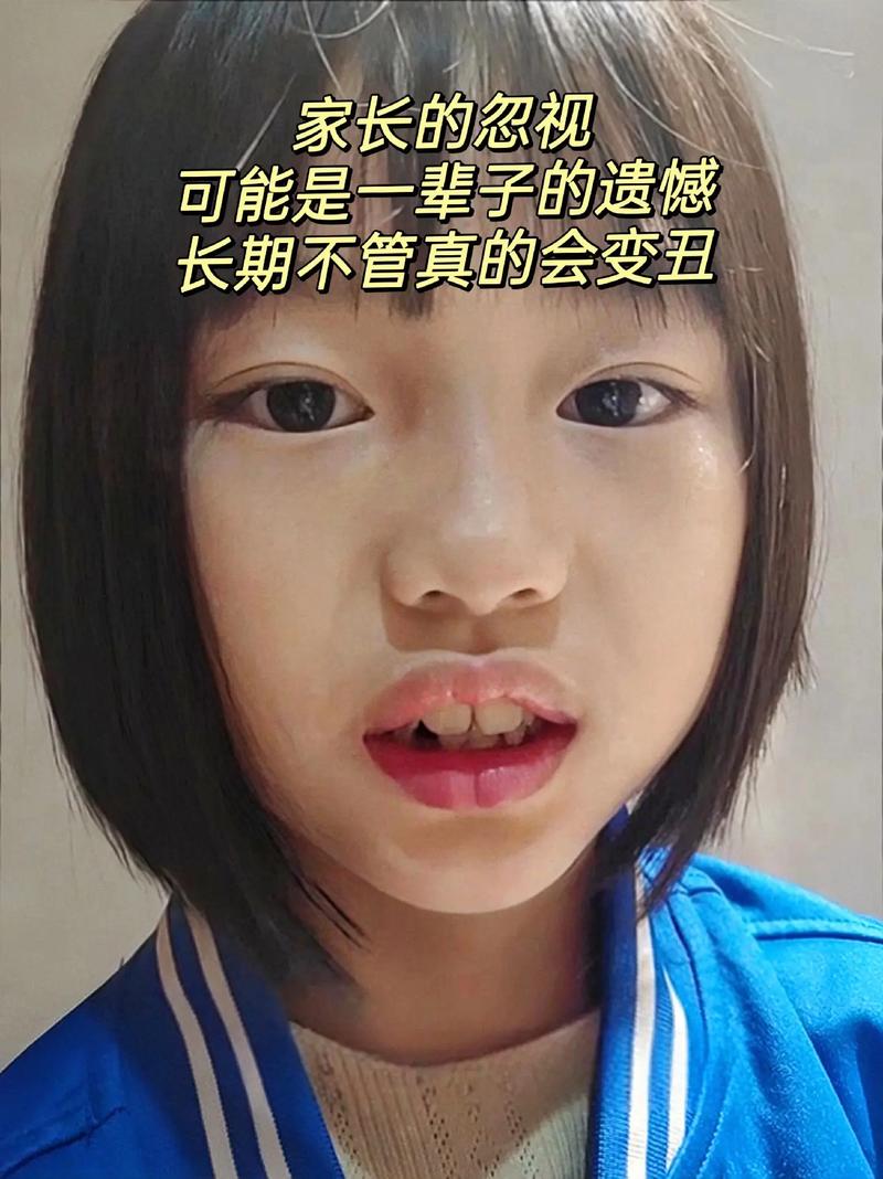 孩子面容特征