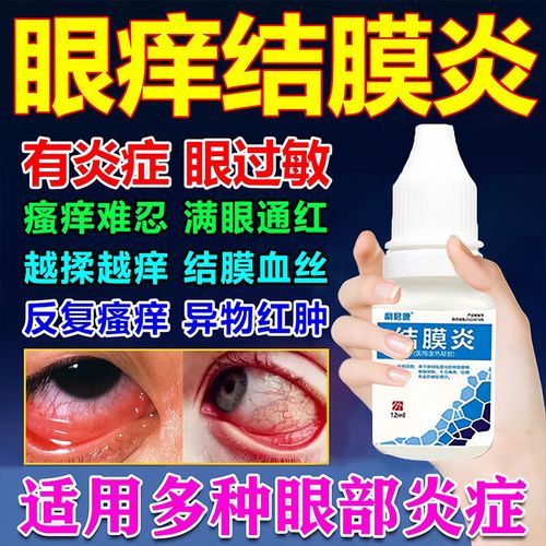 鼻炎引起的眼睛干痒及红血丝困扰？