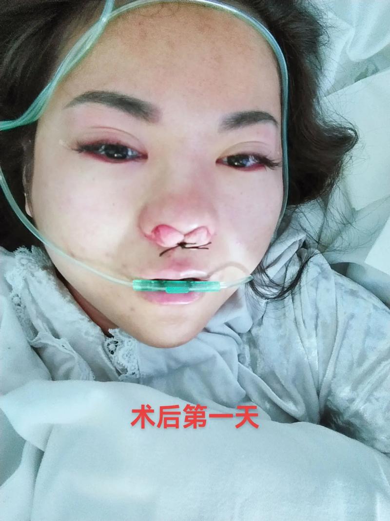 小孩鼻炎的严重后果：会引起死亡吗？