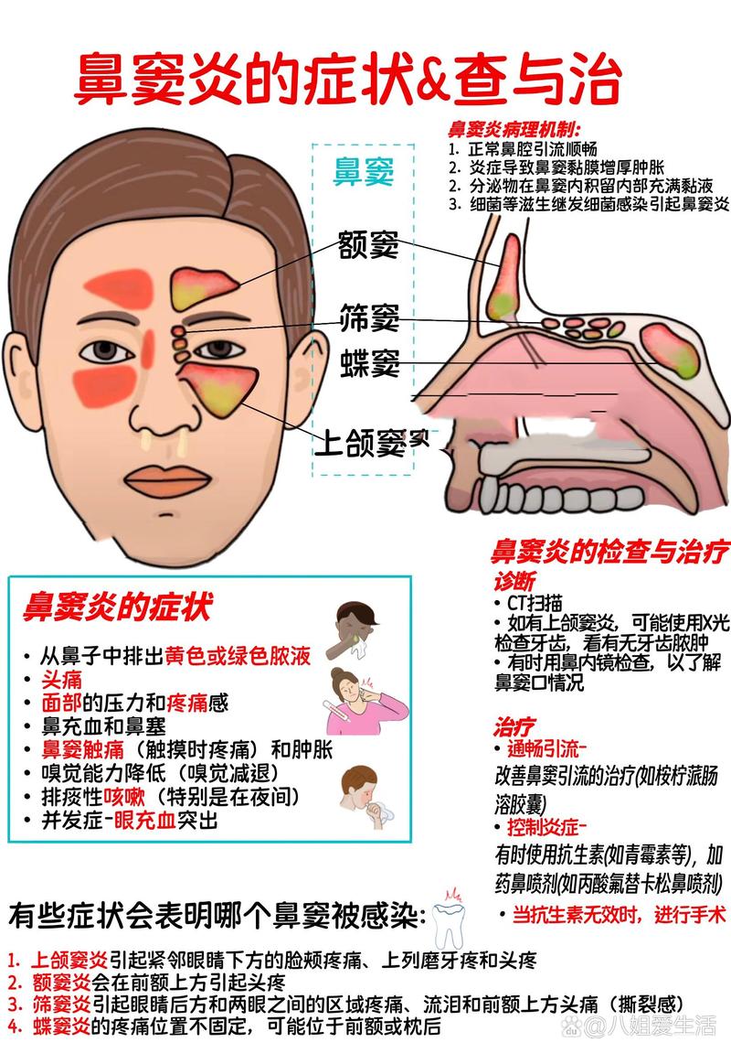 <慢性鼻炎伴鼻旁窦炎>