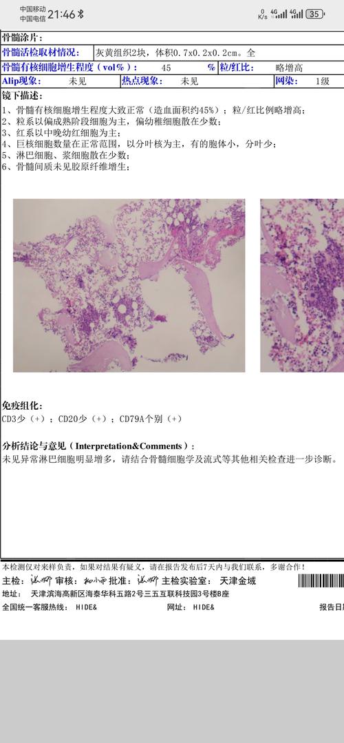 病理活检