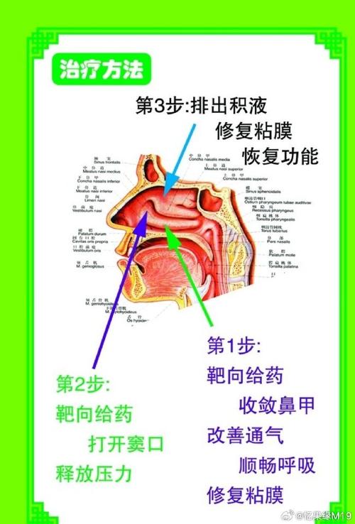 早期鼻炎的最佳治疗方法是什么？