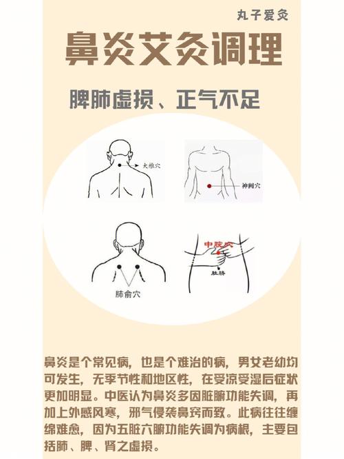 艾灸改善过敏性鼻炎效果显著吗？