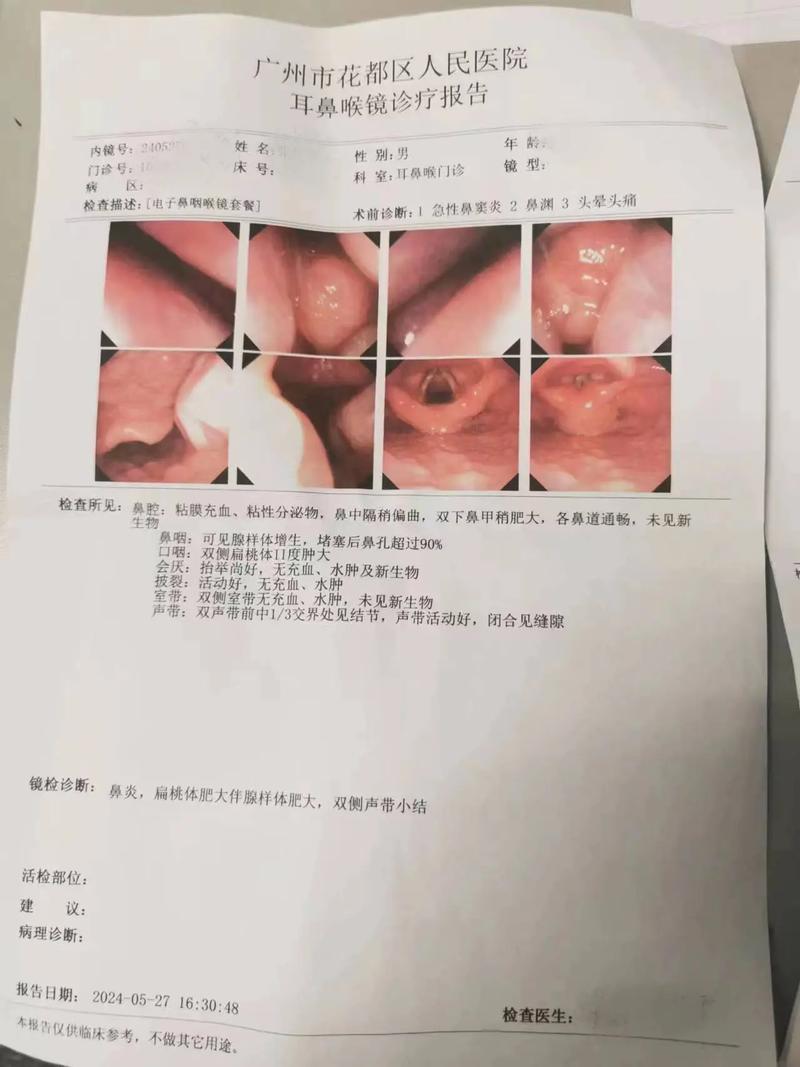 鼻通宁：揭秘其治疗鼻炎的效果如何？