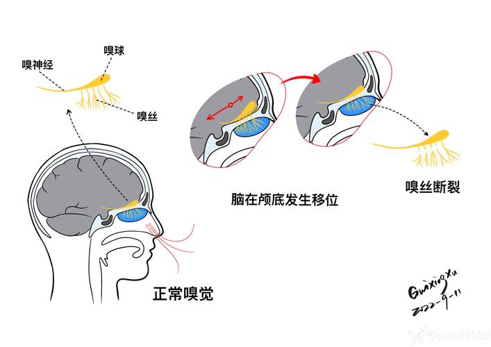 嗅觉