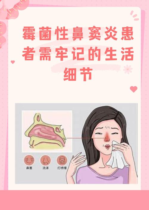 揭秘：鼻炎治疗的智商税，无中生有？