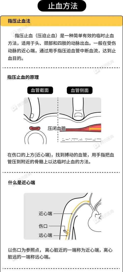 出血应对