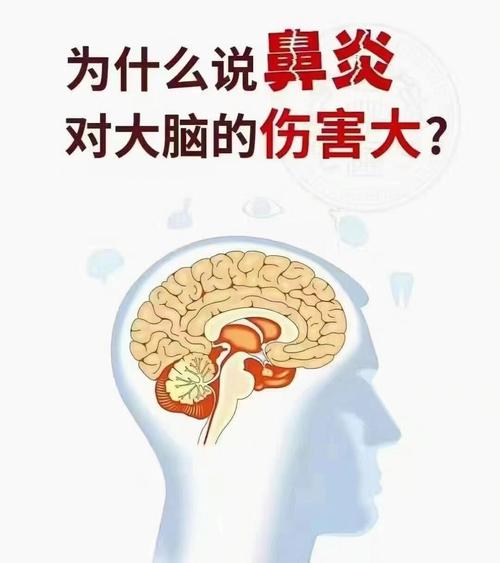 鼻炎对兵役影响探讨：能否服兵役？