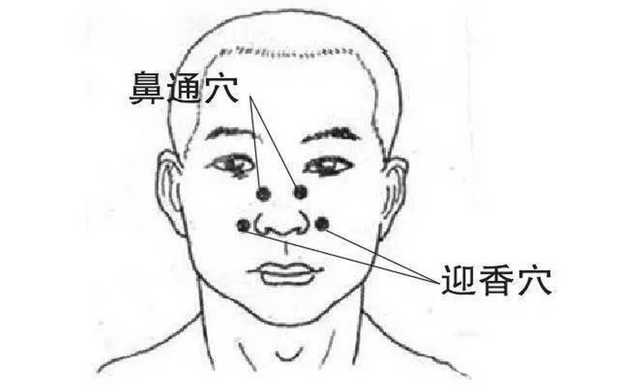 利群医院：鼻炎治愈有妙法吗？