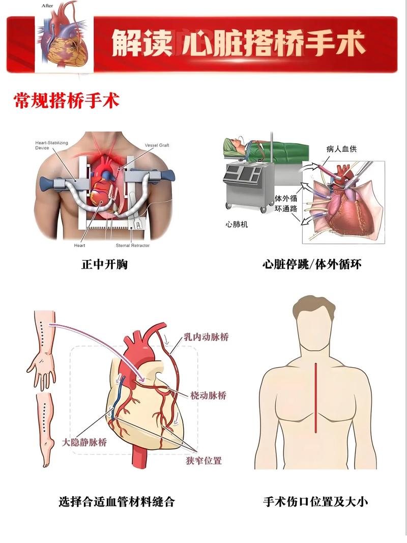 治疗方式