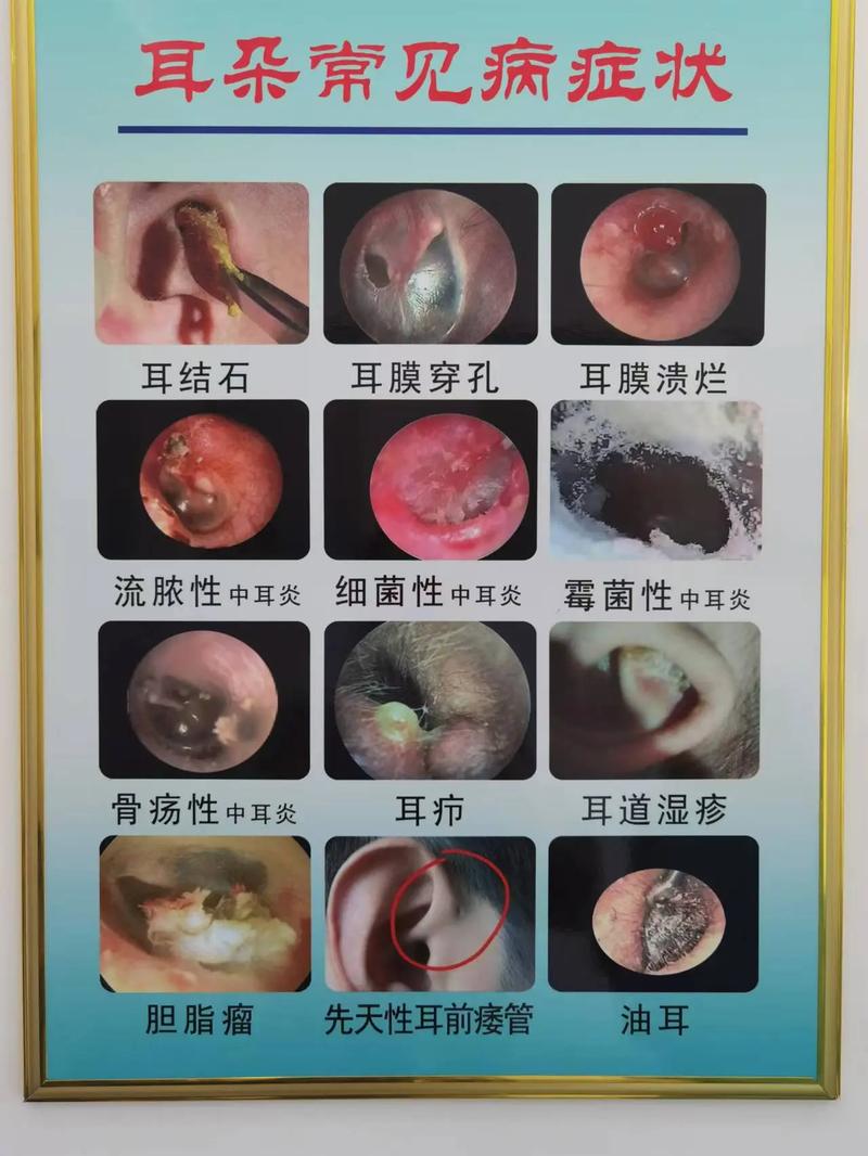 耳部不适